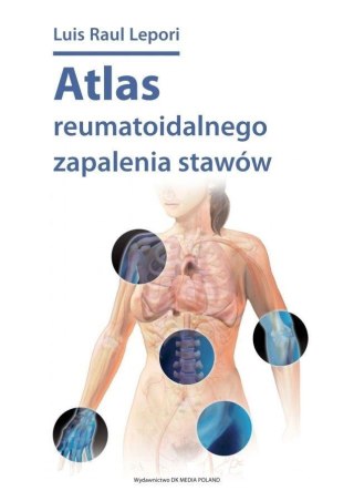 Atlas reumatoidalnego zapalenia stawów