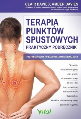 Terapia punktów spustowych praktyczny podręcznik