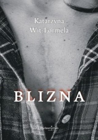 Blizna