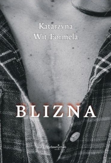 Blizna