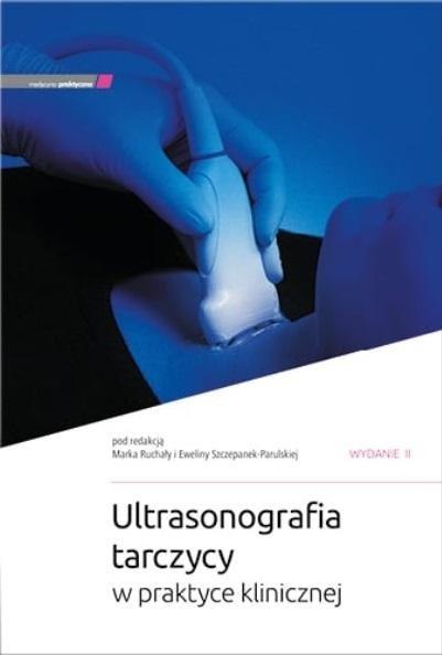 Ultrasonografia tarczycy w praktyce klinicznej w.2 Ultrasonografia tarczycy w praktyce klinicznej w.2