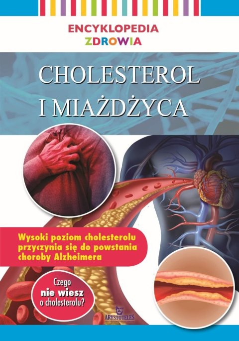 Cholesterol i miażdżyca. Encyklopedia zdrowia Cholesterol i miażdżyca. Encyklopedia zdrowia